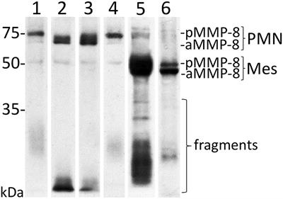 aMMP-8 Oral Fluid PoC Test in Relation to Oral and Systemic Diseases